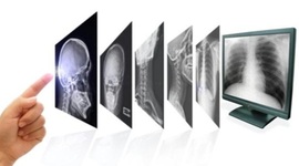 Timeline: EVOLUCIÓN DE LA RADIOLOGÍA