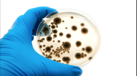 Timeline: Humans and The Microbial World