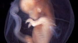 Timeline: fetal development