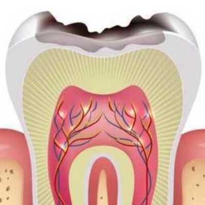 Timeline: CARIOLOGIA - RUFINO HERNÁNDEZ
