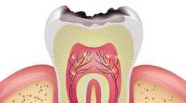 Timeline: CARIOLOGIA - RUFINO HERNÁNDEZ