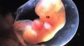 Timeline: Fetal Development