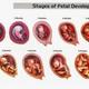 Fetal development