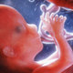 Fetus