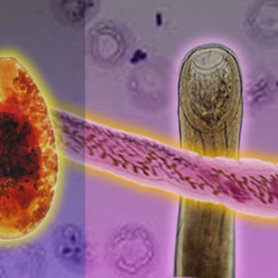 Timeline: Historia de la Parasitologia