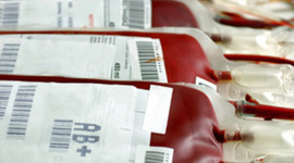 Timeline: Blood Transfusion