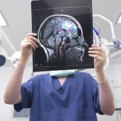 Timeline: Avances científicos del cerebro humano