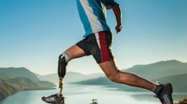 Timeline: Timeline of Prosthetics