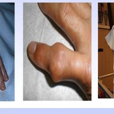 Timeline: caso clinico 3