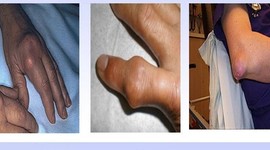 Timeline: caso clinico 3