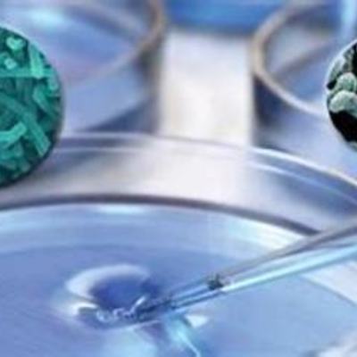 Timeline: Mundo de Bacterias | Historia de la Microbiología