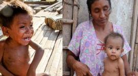 Timeline: Desnutricion en la Guajira