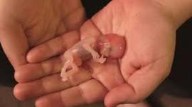 Timeline: El aborto legal