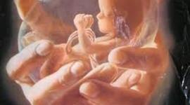 Timeline: TIPOS DE ABORTO