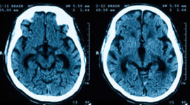 Timeline: Tomografía