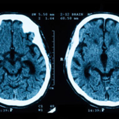 Timeline: TOMOGRAFIA