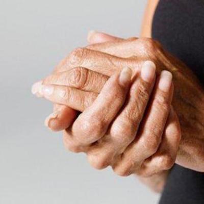 Timeline: Osteoporosis