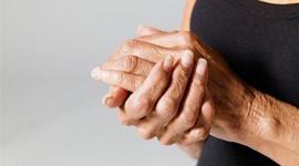 Timeline: Osteoporosis