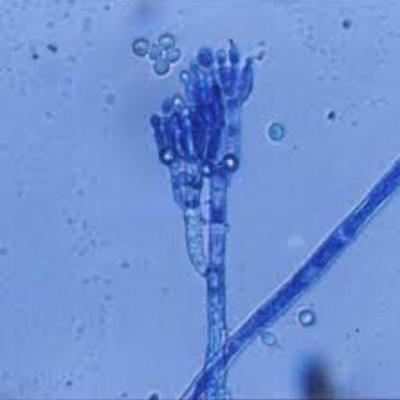 Timeline: Peores epidemias causadas por hongos fitopatógenos