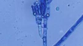 Timeline: Peores epidemias causadas por hongos fitopatógenos