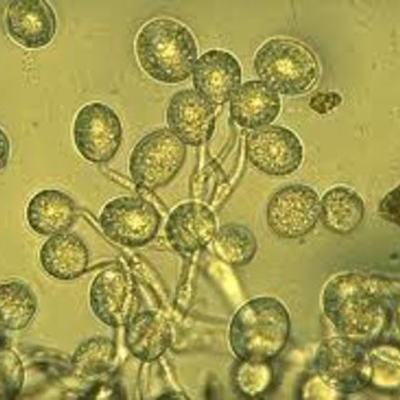 Timeline: Epidemias fitopatológicas