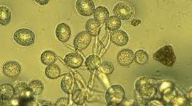 Timeline: Epidemias fitopatológicas