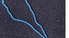 Timeline: Molécula portadora de la información genética