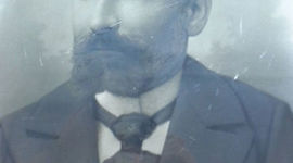 Timeline: Historia Cirugía pediátrica