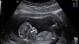 Timeline: Desarrollo Prenatal