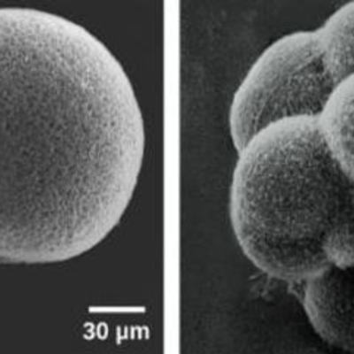 Timeline: Teoría Celular