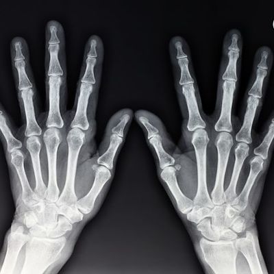 Timeline: eventos históricos sobre la tecnología radiológica