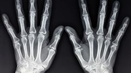 Timeline: eventos históricos sobre la tecnología radiológica