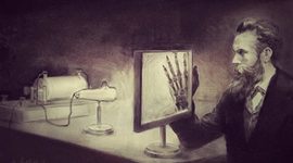 Timeline: Historia de la radiología