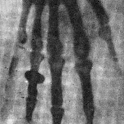 Timeline: Historia de la Radiología