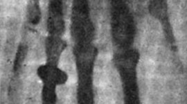 Timeline: Historia de la Radiología