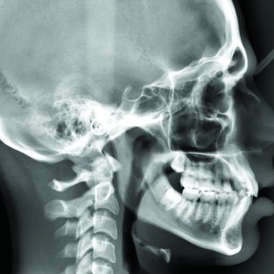 Timeline: Historia de la Radiología