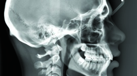 Timeline: Historia de la Radiología