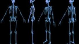 Timeline: Eventos importantes en la historia de la Radiología