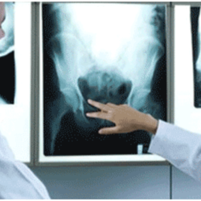 Timeline: Historia de la Radiología