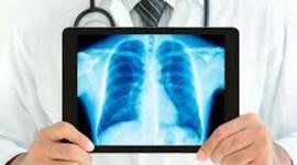 Timeline: Historia de Radiología