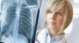 Timeline: Historia de la Radiología