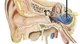 Timeline: Historia de la Otología