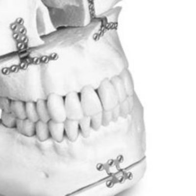 Timeline: Historia de los  Biomateriales