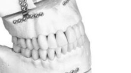 Timeline: Historia de los  Biomateriales