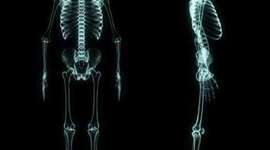 Timeline: Historia de los Rayos X