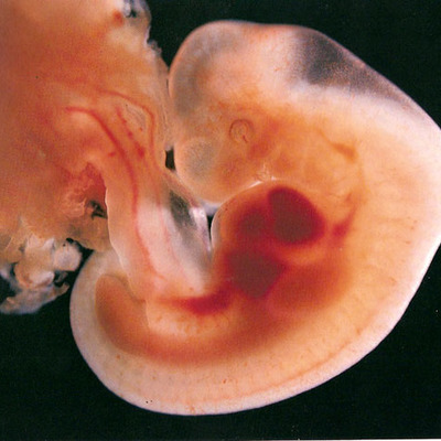 Timeline: DESARROLLO EMBRIONARIO