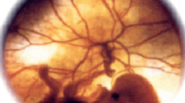 Timeline: Desarrollo embrionario.