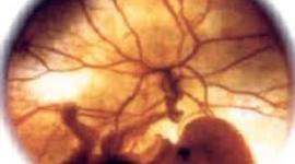 Timeline: periodo embrionario