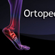 Ortopedia