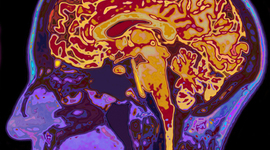 Timeline: Historia del cerebro